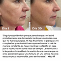 Rejuvenecedor Facial Lifting Pro™