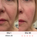 Rejuvenecedor Facial Lifting Pro™